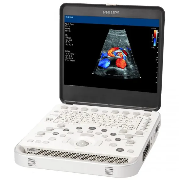 Ультразвуковая система Philips CX50